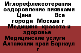 Иглорефлексотерапия, оздоровление пиявками › Цена ­ 3 000 - Все города, Москва г. Медицина, красота и здоровье » Медицинские услуги   . Алтайский край,Барнаул г.